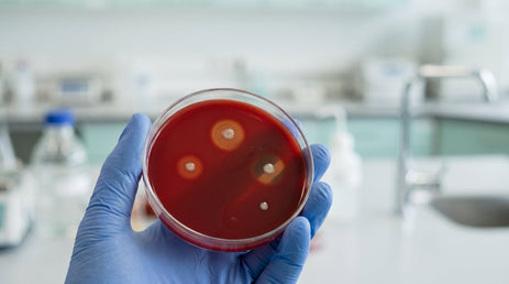 Ágar Sangue de Carneiro: meio enriquecido e padrões de hemólise
