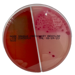 Ágar Sangue / MacConkey – Biplaca (10 unidades, 90 × 15 mm)