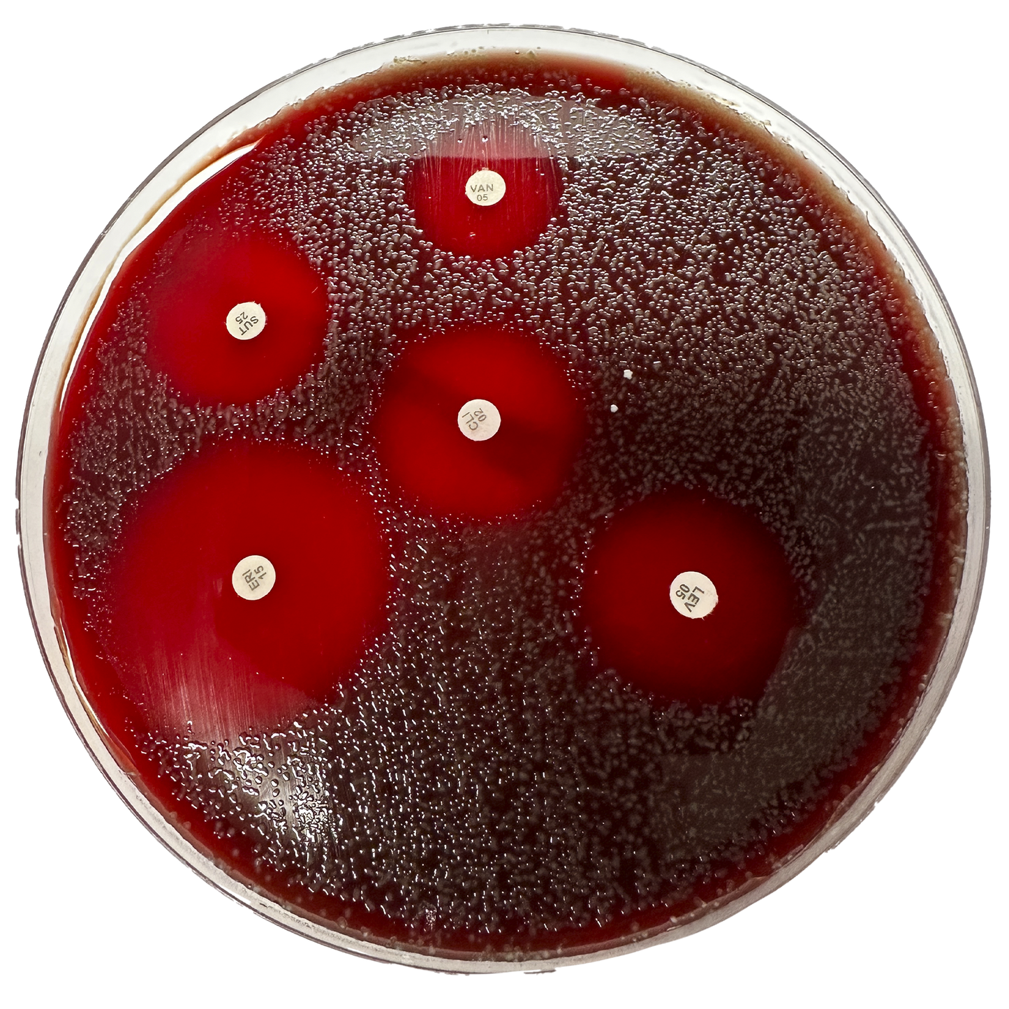 Ágar Mueller Hinton + Sangue – 10 Placas (140 × 15 mm)