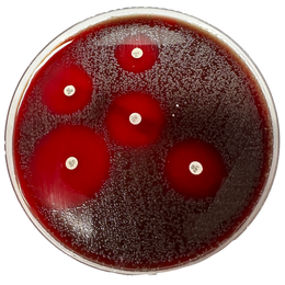 Ágar Mueller Hinton + Sangue – 10 Placas (140 × 15 mm)