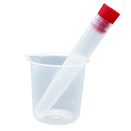 Kit Tubo de Urina PP 12 mL Tampa Vermelha Estéril – Caixa c/900
