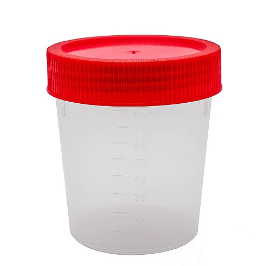Coletor Universal 80 mL Estéril (Tampa Vermelha) – Pacote com 100 Unidades